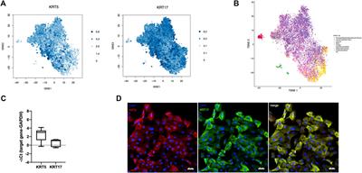 Basal-Like Cell-Conditioned Medium Exerts Anti-Fibrotic Effects In Vitro and In Vivo